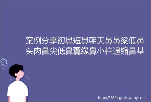 案例分享初鼻短鼻朝天鼻鼻梁低鼻头肉鼻尖低鼻翼缘鼻小柱退缩鼻基底凹陷